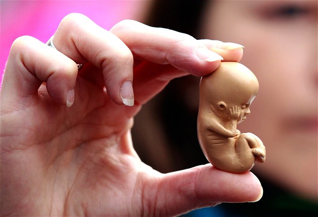 Většina Čechů souhlasí s eutanazií, zákaz potratů chce jen naprosté minimum lidí