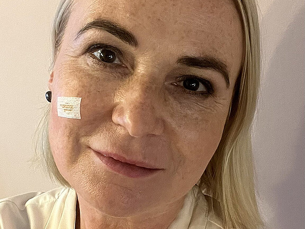 Černochové odstranili bazaliom. Čeká na výsledky. Držte mi palce, prosí