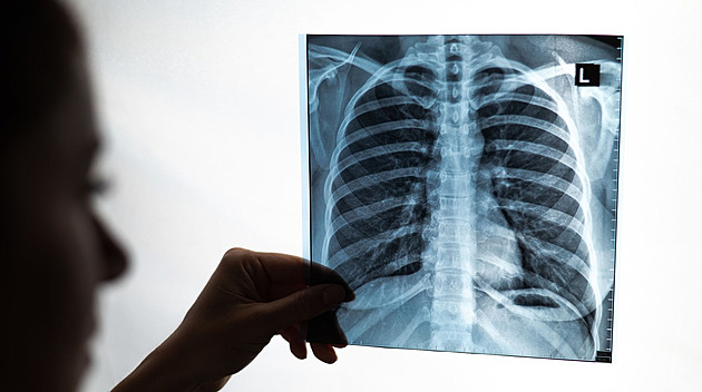 Lepší cesta systémem. Lidem s rakovinou pomohou koordinátoři i nové centrum